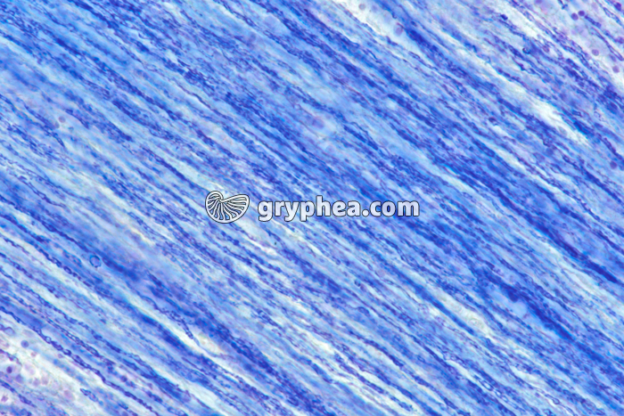 Sclérose en plaques - pour comparaison : substance blanche avec fibres nerveuses pourvues d'une gaine de myéline normale x100 - gryphea.com